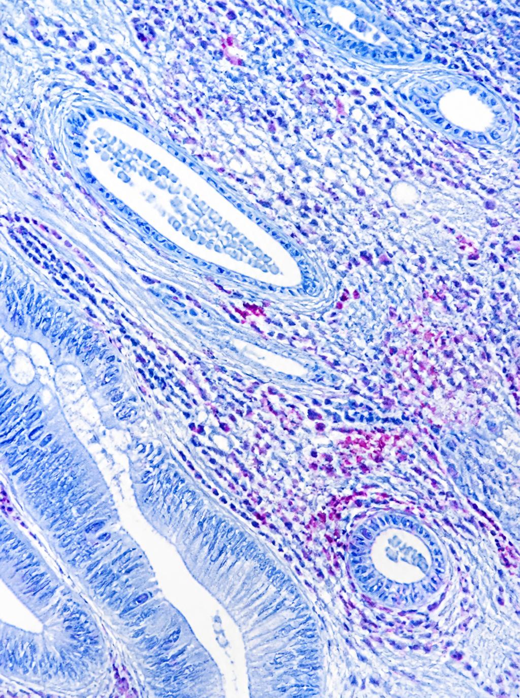 Histology image of an inflammatory tissue microenvironment